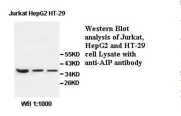 ARA9 / AIP Antibody
