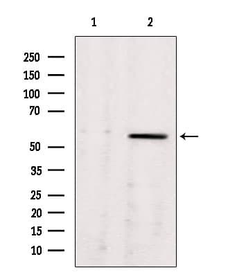 ALDH7A1 Antibody