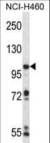 Polyclonal Rabbit anti-Human RC3H1 / ROQUIN Antibody (aa1015-1043, IHC, WB)