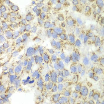 Polyclonal Rabbit anti-Human P5CDH / ALDH4A1 Antibody (IHC, IF, WB)