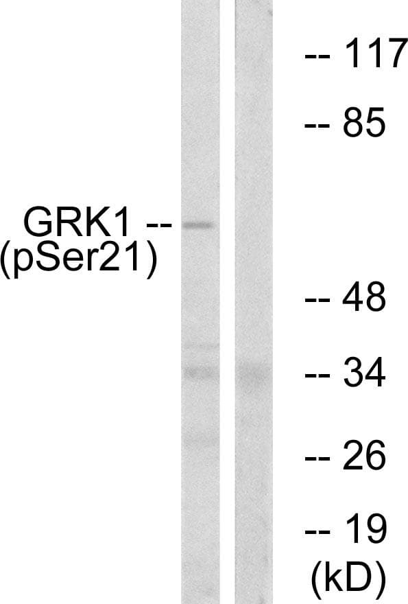 Polyclonal Rabbit anti-Human Rhodopsin Kinase / GRK1 Antibody (phospho-Ser21, IHC, WB)