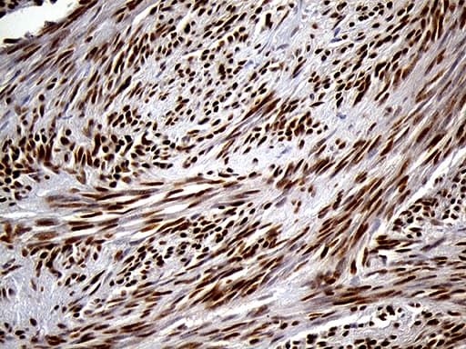 Monoclonal Mouse anti-Human SPANXB1 Antibody (clone OTI1E11, IHC, WB)