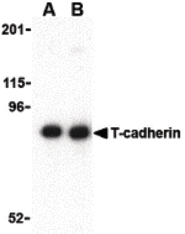 IHC-plus™ Polyclonal Rabbit anti-Human CDH13 / Cadherin 13 Antibody (IHC, IF, WB)