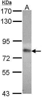 MTHFR Antibody (aa21-248)