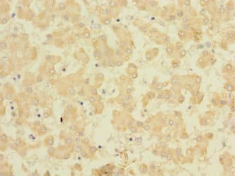 Polyclonal Rabbit anti-Human FAM187B Antibody
