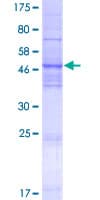 Human TMEM41A Protein (Recombinant GST)