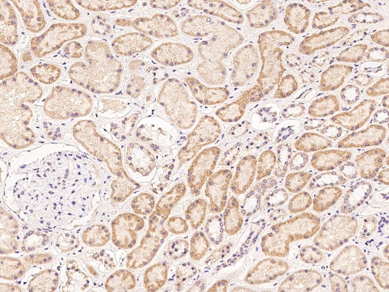 Polyclonal Rabbit anti-Human KIF25 Antibody (IHC)