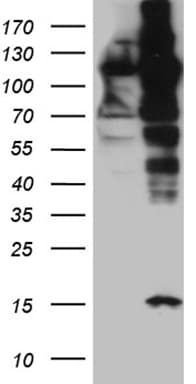 Monoclonal Mouse anti-Human IPO5 / RANBP5 Antibody (clone OTI1C5, aa1-220, WB)