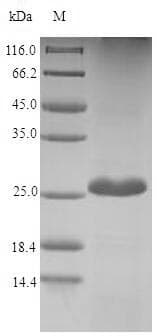 Green mamba Fasciculin-2 Protein (Recombinant 6His-SUMO, N-terminus)