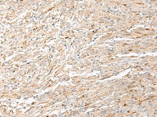 EPRS / PARS Antibody