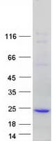 Human TMEM80 Protein (Recombinant Myc-DDK (Flag))