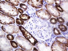 CA12 / Carbonic Anhydrase XII Antibody (clone OTI1A6)