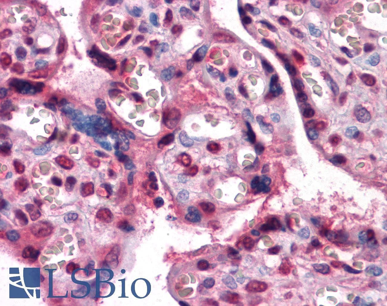 IHC-plus™ Monoclonal Mouse anti-Human ZBTB7B / HcKrox Antibody (clone 7C12, IHC, IF, WB)