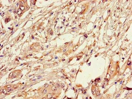 PLIN3 / M6PRBP1 / TIP47 Antibody