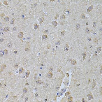 NME1 / NM23 Antibody