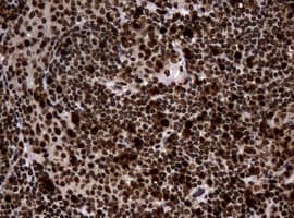 PCNA Antibody (clone OTI6A10)