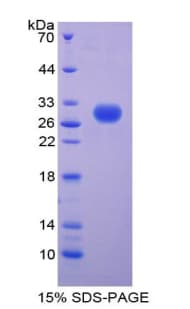 Human PGLYRP2 Protein (Recombinant His, N-Terminal)