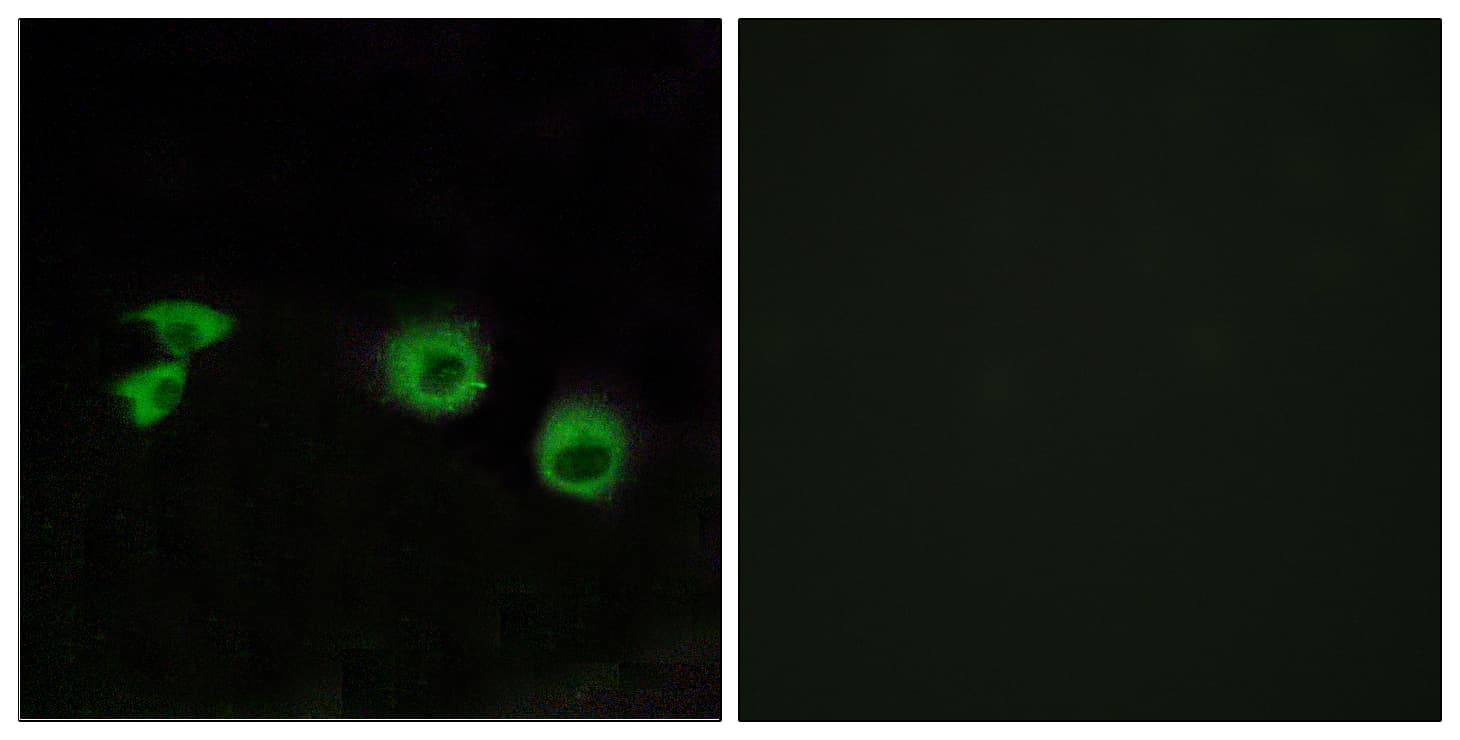 Polyclonal Rabbit anti-Human TRAF3IP1 Antibody (aa221-270, IHC, IF)