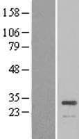 ATP6E / ATP6V1E1 Protein (Over-Expression Lysate Myc-DDK (Flag))