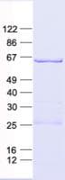 Human HSPD1 / HSP60 Protein (Recombinant His, N-Terminal)