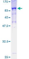 Human POLA2 / DNA Polymerase Alpha 2 Protein (Recombinant GST)