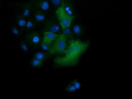 TRIM38 Antibody (clone OTI15B10)