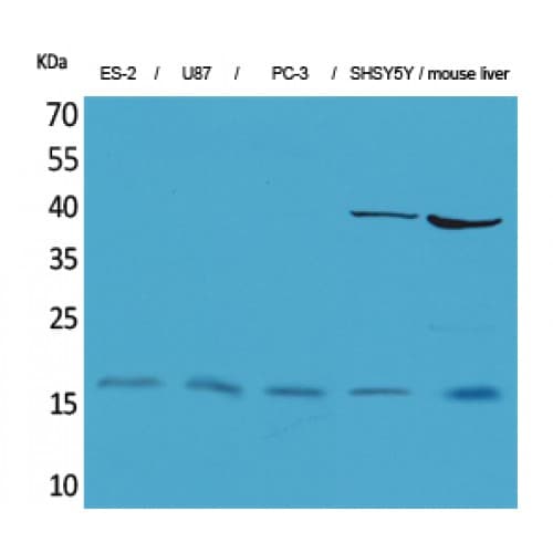 IL-1B / IL-1 Beta Antibody (Internal)