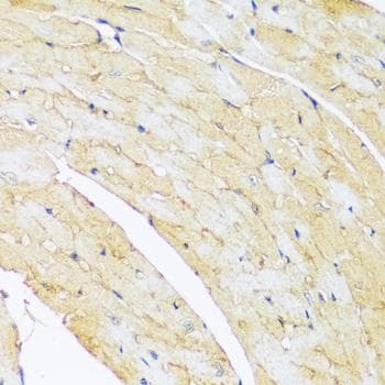 Polyclonal Rabbit anti-Human ARL4A / ARL4 Antibody (IHC, IF)