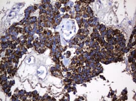 HSPD1 / HSP60 Antibody (clone OTI6F11, Carrier-free)