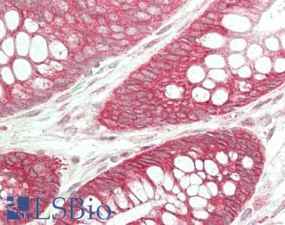 IHC-plus™ PGR1 / GPR153 Antibody (Internal)