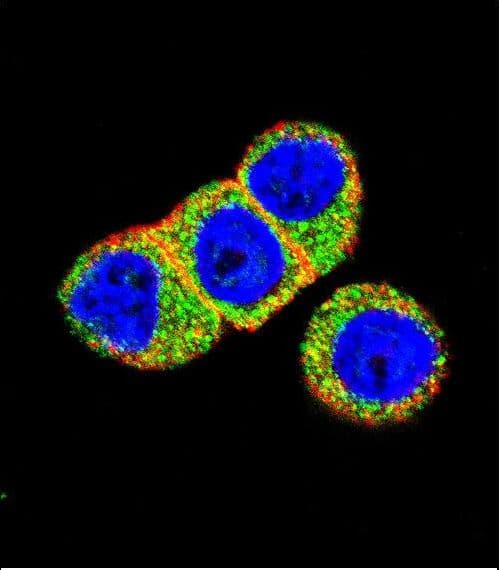 AKT2 Antibody (aa93-123)