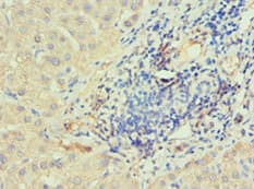 Polyclonal Rabbit anti-Human IRAK2 / IRAK-2 Antibody (aa1-270, IHC)