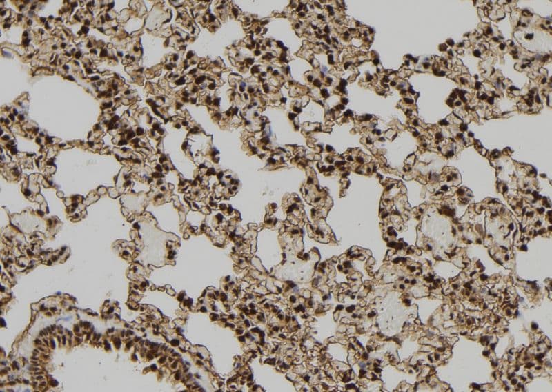 PDX1 Antibody