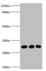 Polyclonal Rabbit anti-Human CA1 / Carbonic Anhydrase I Antibody (aa1-261, IHC, WB)