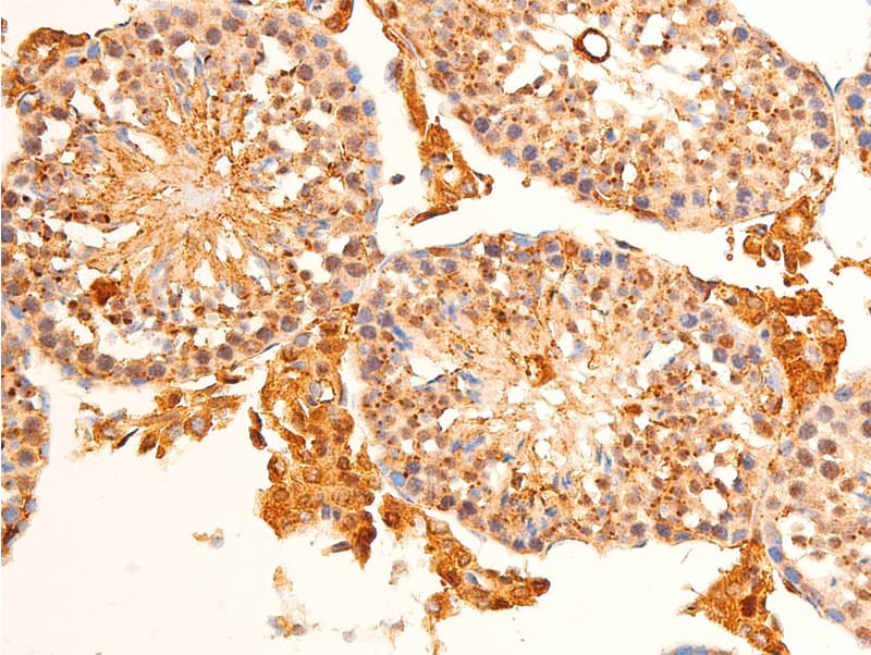 JUN / c-Jun Antibody (phospho-Ser63)