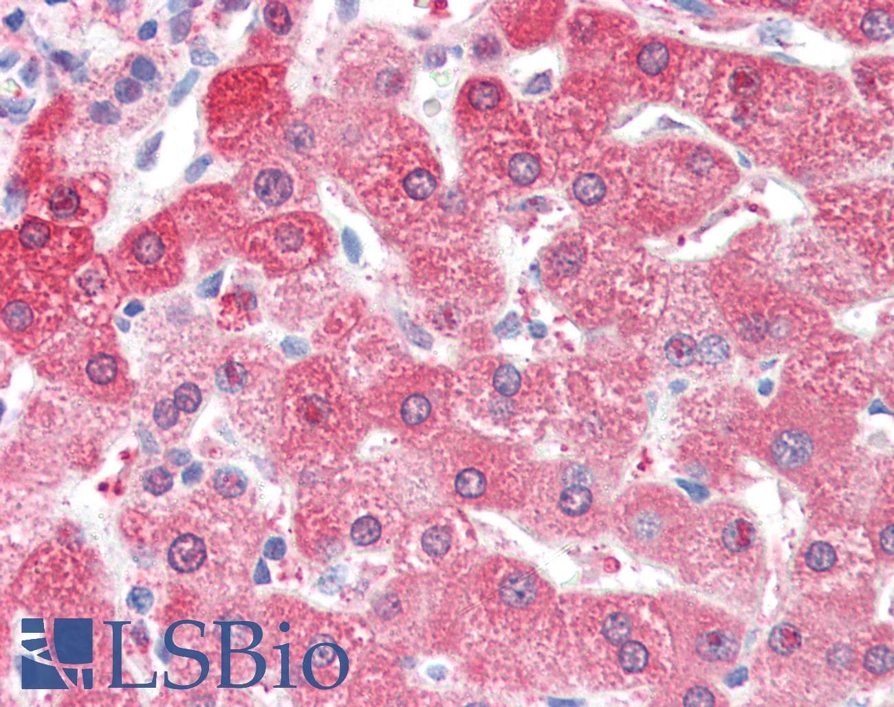 IHC-plus™ Polyclonal Rabbit anti-Human ALDH2 Antibody (aa52-81, IHC, IF, WB)