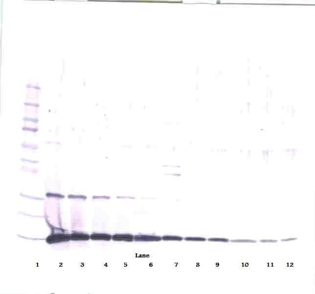 CSF2 / GM-CSF Antibody (Biotin)