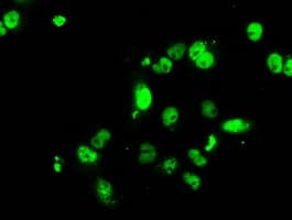 RPA2 / RFA2 / RPA34 Antibody (clone OTI3A12, Carrier-free)