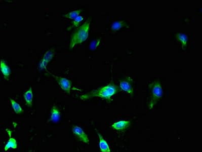 SLC25A18 Antibody