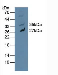 MAPK10 / JNK3 Antibody (aa88-332)