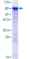 Human COT / CROT Protein (Recombinant GST)
