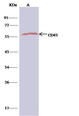 Polyclonal Rabbit anti-Human SPN / CD43 Antibody (Preservative Free, WB)