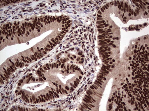 Monoclonal Mouse anti-Human SAE1 Antibody (clone OTI6B11, IHC, WB)