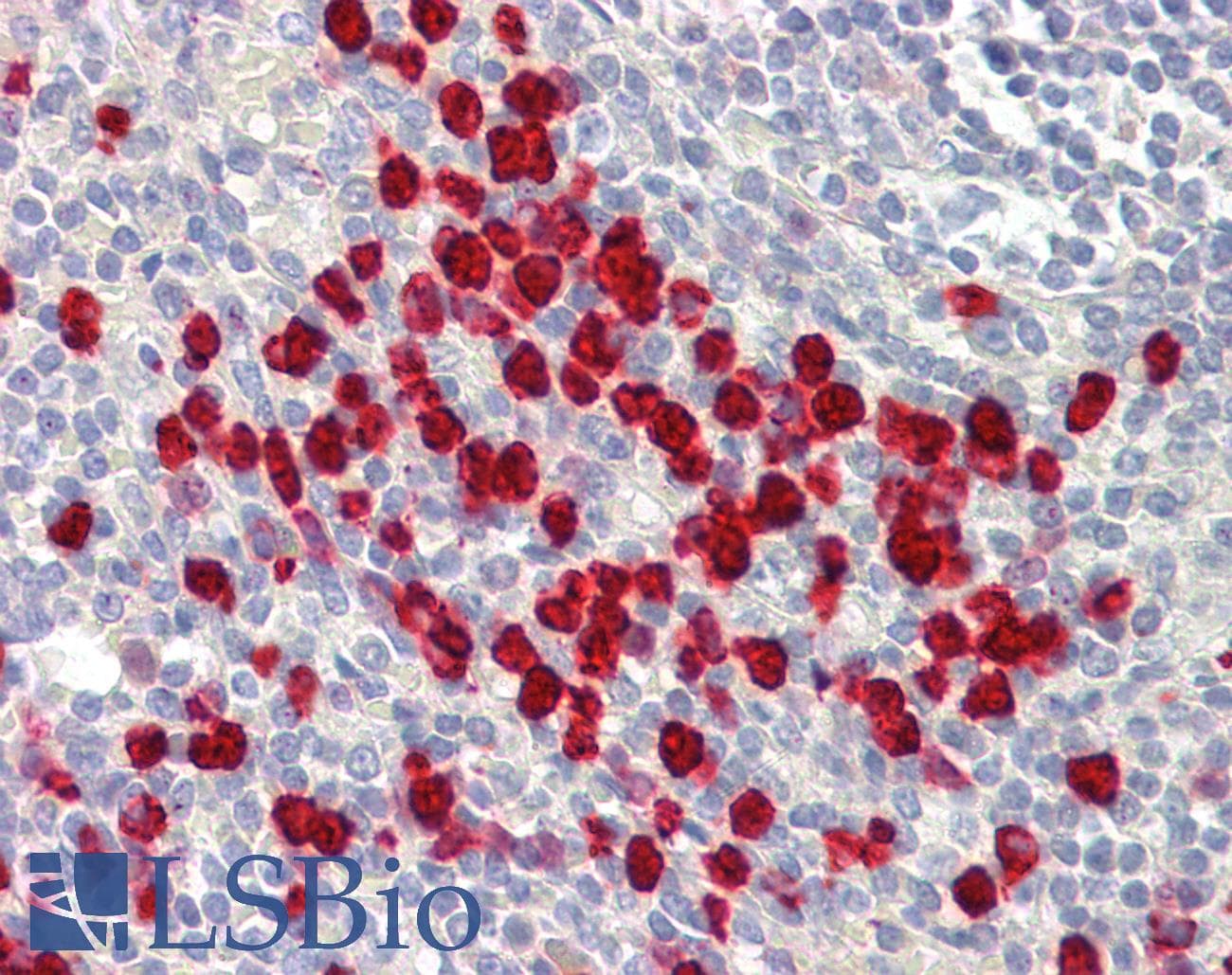 IHC-plus™ Polyclonal Rabbit anti-Human LONP2 / LONP Antibody (aa780-829, IHC)