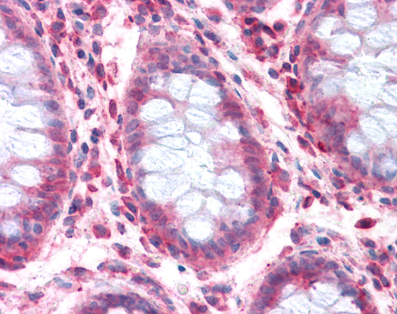 IHC-plus™ SLC1A4 / ASCT1 Antibody (Internal)