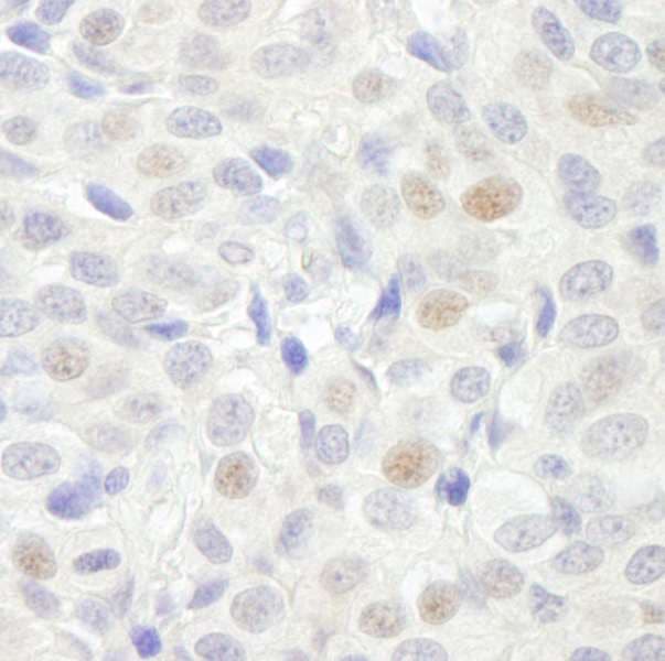 Polyclonal Rabbit anti-Human GTF3C3 Antibody (aa475-525, IHC)