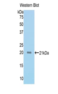 ACVR2 / ACVR2A Antibody (aa326-485, PE)