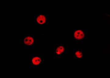 TBX15+18 Antibody