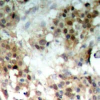 MAP2K7 / MEK7 Antibody (phospho-Ser271)