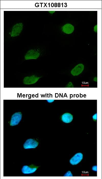 Polyclonal Rabbit anti-Human CBFA2T2 / MTGR1 Antibody (aa401-604, WB)